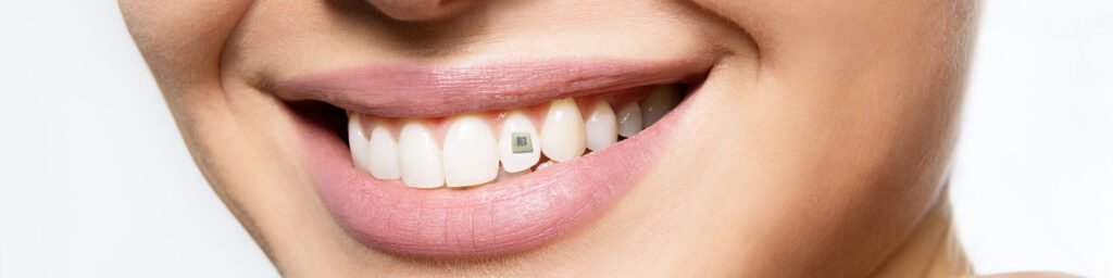 Ernährungschip soll gefährliche Stoffe für Zähne und Gesundheit identifizieren