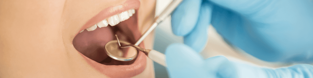 Zahnreinigung und Prophylaxe