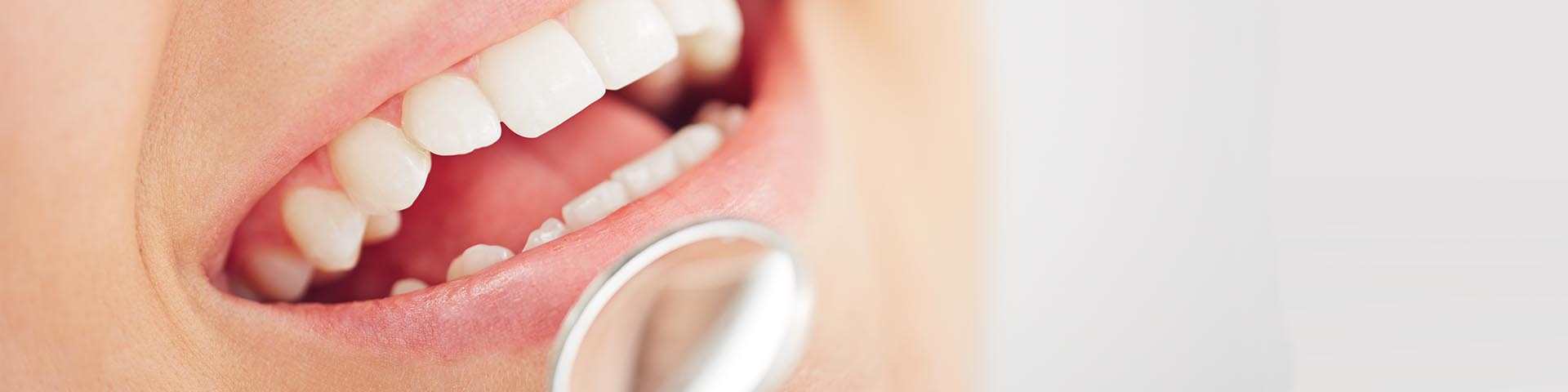 Gesunde Zahne Durch Zahnaufbau Maxcare